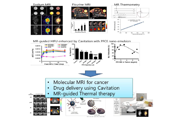 Molecular MRI for cancer, Drug delivery using Cavitation, MR-guided Thermal therapy