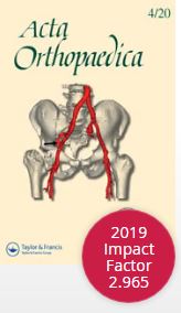 New 3-dimensional implant application as an alternative to allograft in limb salvage surgery: a technical note on 10 cases (letter)