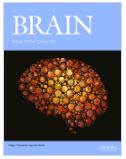 Modulation of Nogo receptor 1 expression orchestrates myelin-associated infiltration of glioblastoma