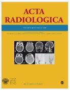 Diagnostic value of mammography for accompanying non-mass enhancement on preoperative breast MRI