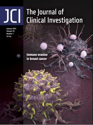 Doubling up on function: dual-specificity tyrosine-regulated kinase 1A (DYRK1A) in B cell acute lymphoblastic leukemia.