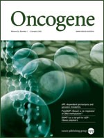 Epigenetic regulation of RNA polymerase III transcription in early breast tumorigenesis