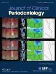 Association between inflammatory potential of diet and periodontitis disease risks: Results from a Korean population-based cohort study