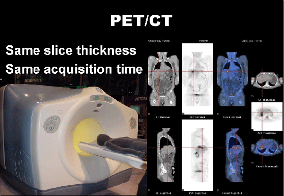 PET/CT Same slice thickness Same acquisition time