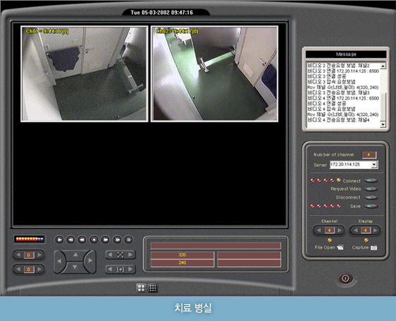치료 병실 CCTV
