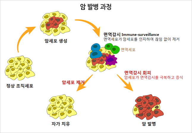 암 발병 과정 : 정상조직세포 - 암세포 생성 - 면역감시(면역세포가 암세포를 인지하여 끊임 없이 제거 - 암세포제거(자가치유), 면역감시 회피 암세포가 면역감시를 극복하고 증식 (암발병)